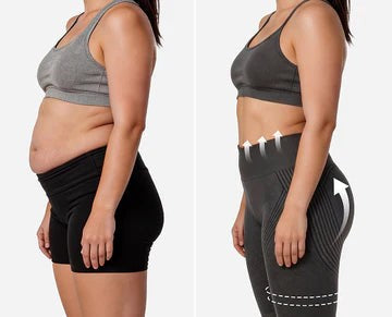 Before & After Results - ELVÉRA 3D Anti-Cellulite Leggings